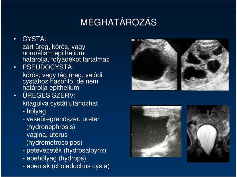 cystát utánozhat - hólyag - veseüregrendszer, ureter (hydronephrosis) - vagina, uterus