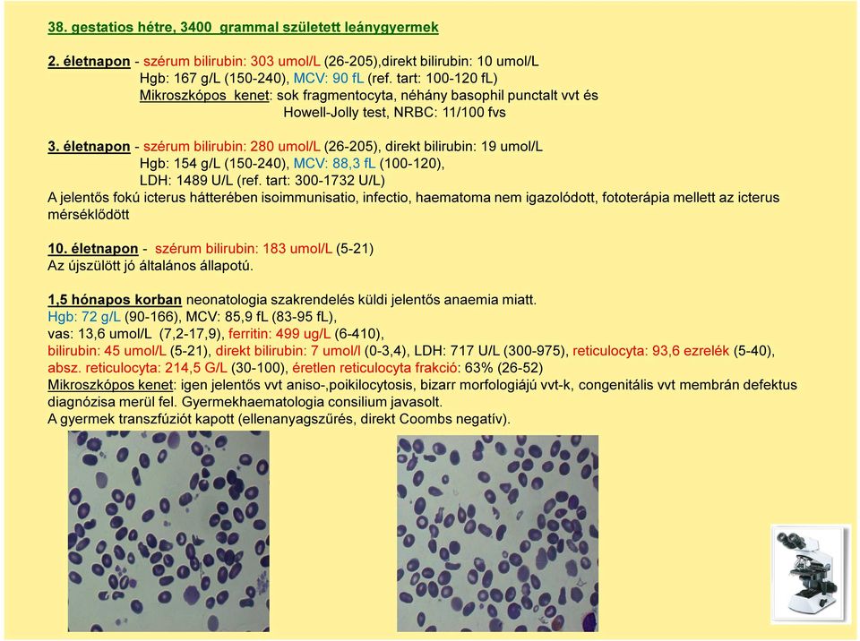 életnapon - szérum bilirubin: 280 umol/l (26-205), direkt bilirubin: 19 umol/l Hgb: 154 g/l (150-240), MCV: 88,3 fl (100-120), LDH: 1489 U/L (ref.