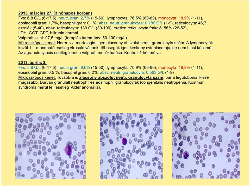 vvt morfologia. Igen alacsony abszolút neutr. granulocyta szám. A lymphocyták közül 1-1 mondható esetleg vírusaktiváltank, többségük igen keskeny cytoplasmájú, de nem blast küllemű.