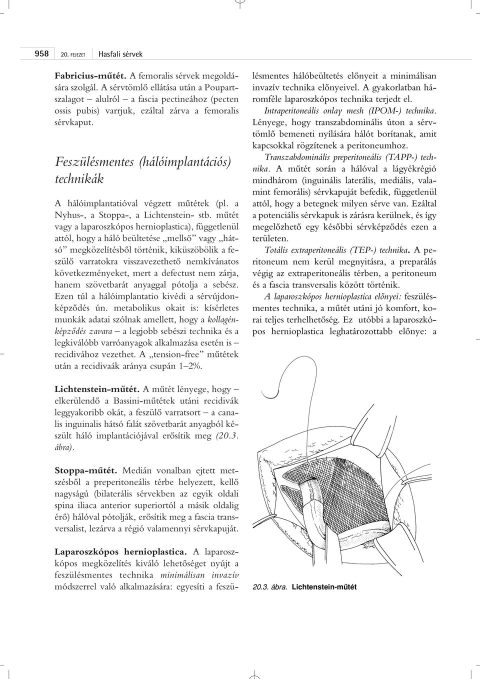 Feszülésmentes (hálóimplantációs) technikák A hálóimplantatióval végzett mûtétek (pl. a Nyhus-, a Stoppa-, a Lichtenstein- stb.