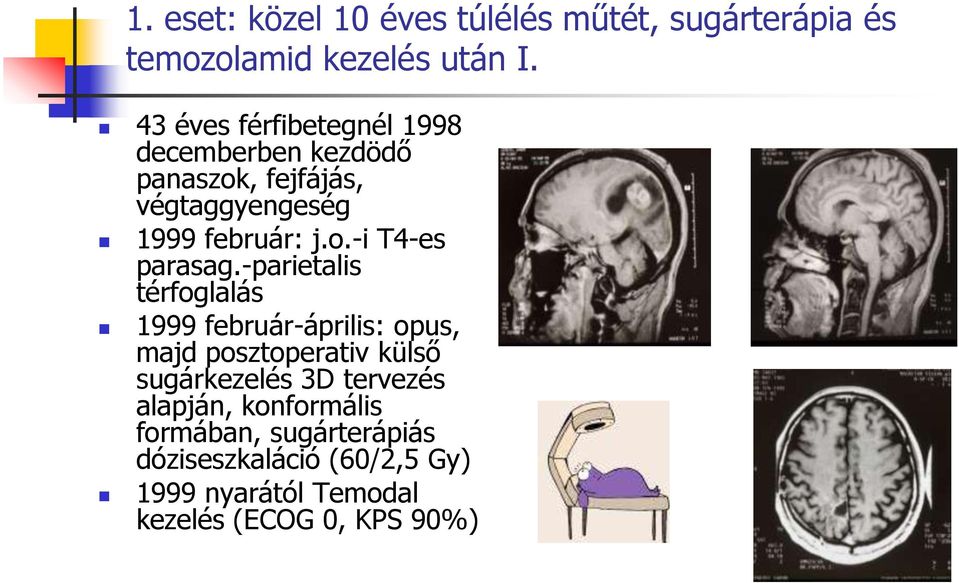 -parietalis térfoglalás 1999 február-április: opus, majd posztoperativ külső sugárkezelés 3D tervezés