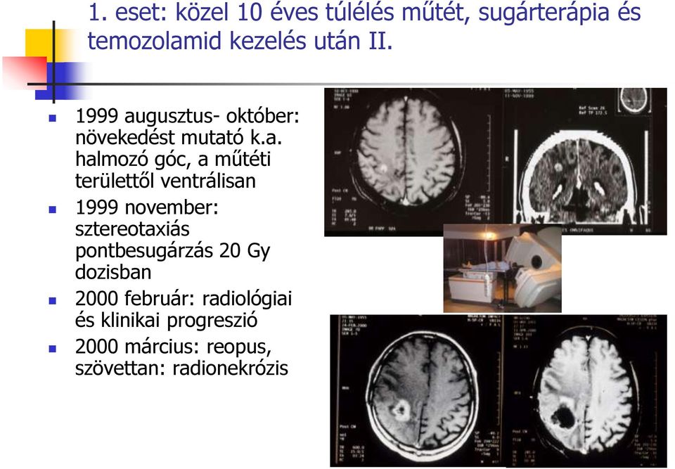 gusztus- október: növekedést mutat