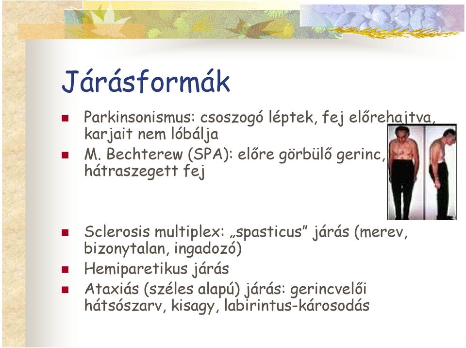 Bechterew (SPA): elıre görbülı gerinc, hátraszegett fej Sclerosis multiplex: