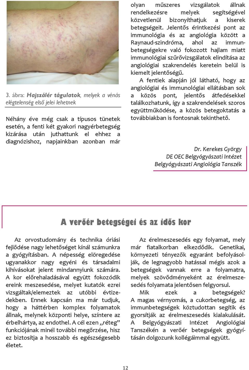Jelentős érintkezési pont az immunológia és az angiológia között a Raynaud-szindróma, ahol az immunbetegségekre való fokozott hajlam miatt immunológiai szűrővizsgálatok elindítása az angiológiai