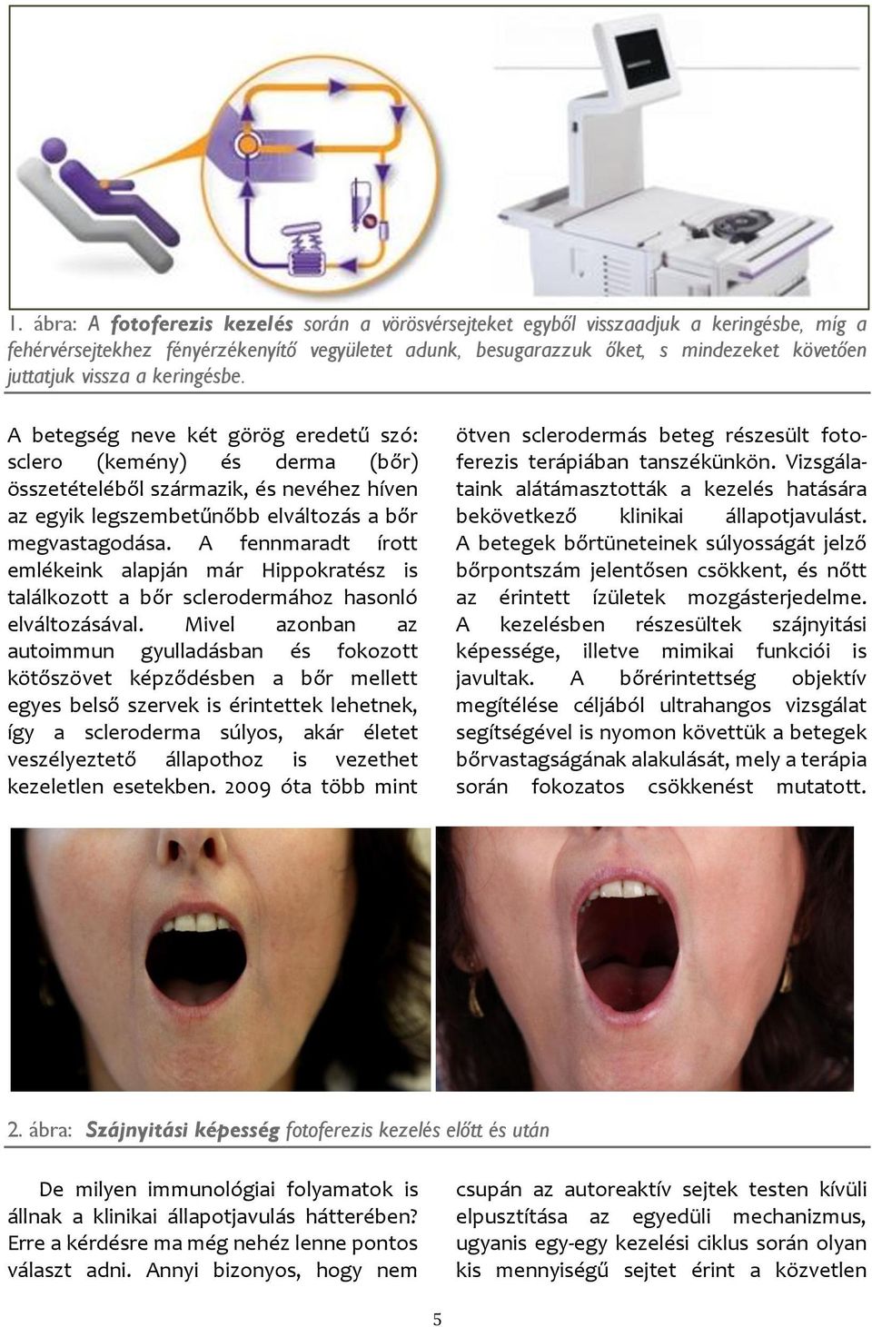 A fennmaradt írott emlékeink alapján már Hippokratész is találkozott a bőr sclerodermához hasonló elváltozásával.