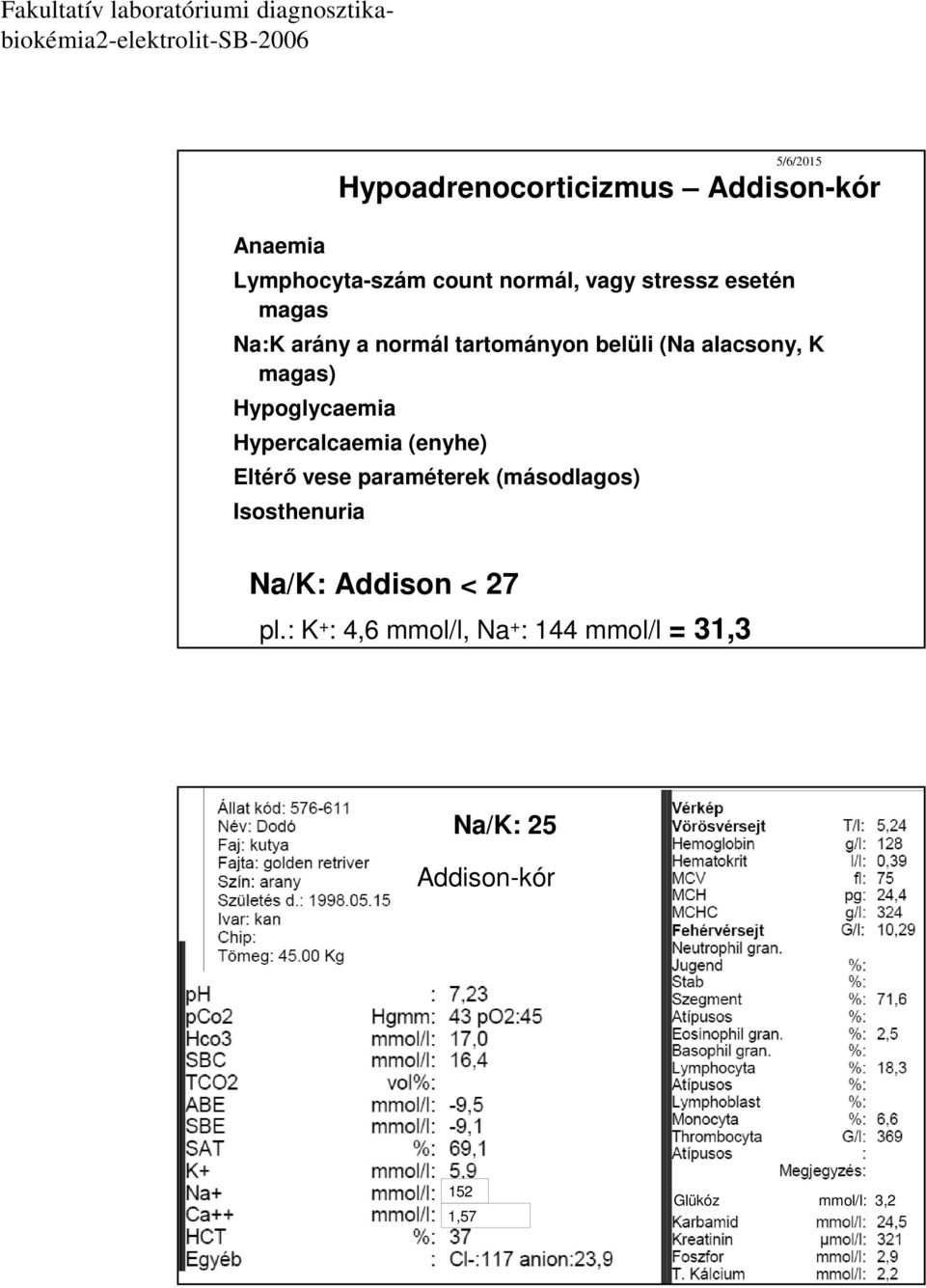 Hypercalcaemia (enyhe) Eltérő vese paraméterek (másodlagos) Isosthenuria Na/K: Addison <