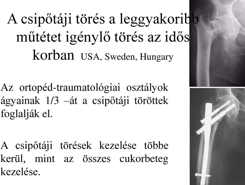 ágyainak 1/3 át a csipőtáji töröttek foglalják el.