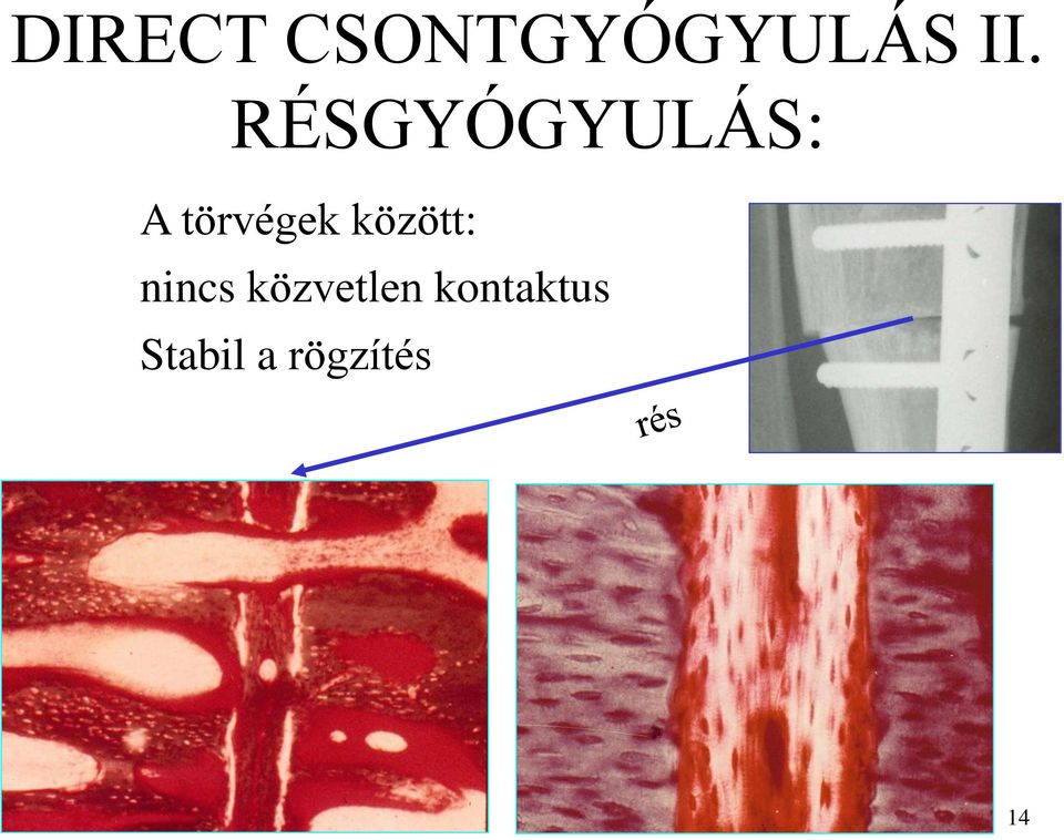 között: nincs közvetlen