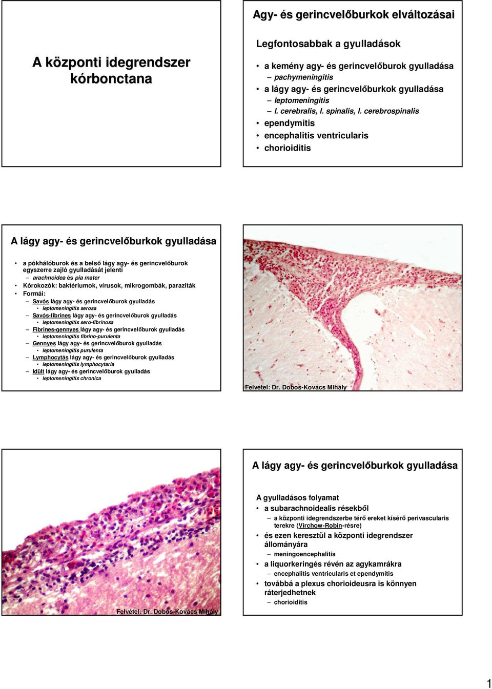 cerebrospinalis ependymitis encephalitis ventricularis chorioiditis A lágy l agy- és s gerincvelıburkok a a pókhálóburok és a belsı lágy agy- és gerincvelıburok egyszerre zajló át jelenti arachnoidea