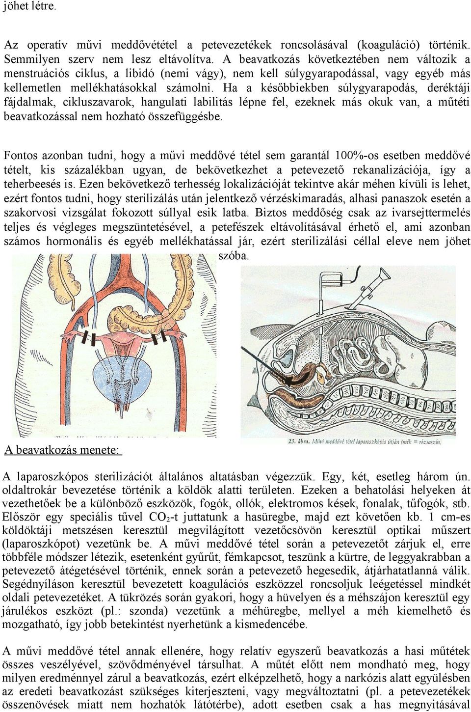 Ha a későbbiekben súlygyarapodás, deréktáji fájdalmak, cikluszavarok, hangulati labilitás lépne fel, ezeknek más okuk van, a műtéti beavatkozással nem hozható összefüggésbe.