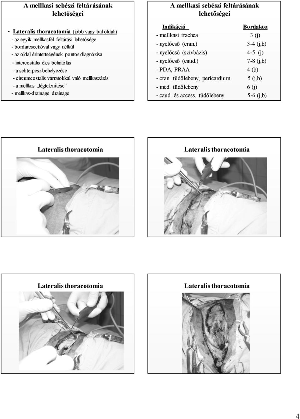 drainage A mellkasi sebészi feltárásának lehetőségei Indikáció Bordaköz - mellkasi trachea 3 (j) - nyelőcső (cran.) 3-4 (j,b) - nyelőcső (szívbázis) 4-5 (j) - nyelőcső (caud.