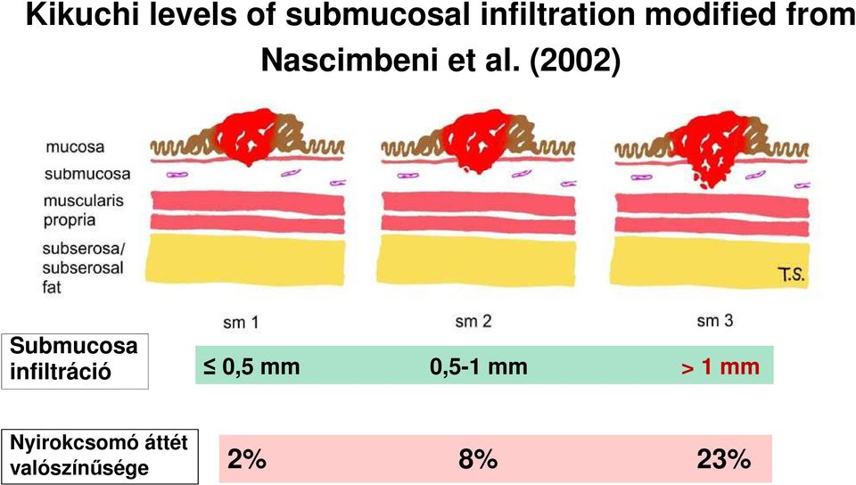 (2002) Submucosa infiltráció 0,5 mm 0,5-1