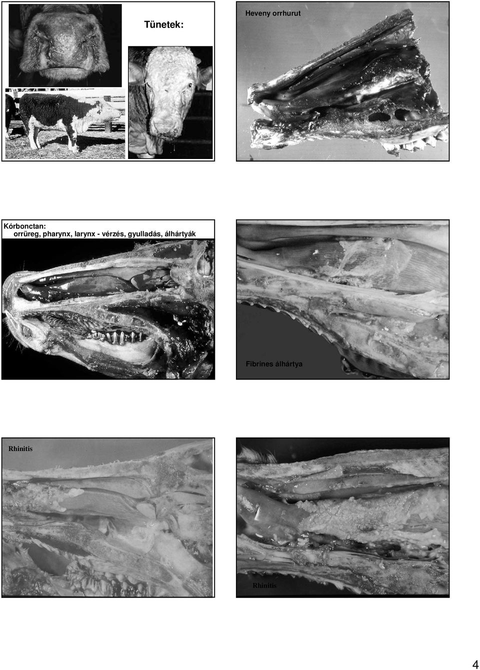 larynx - vérzés, gyulladás,