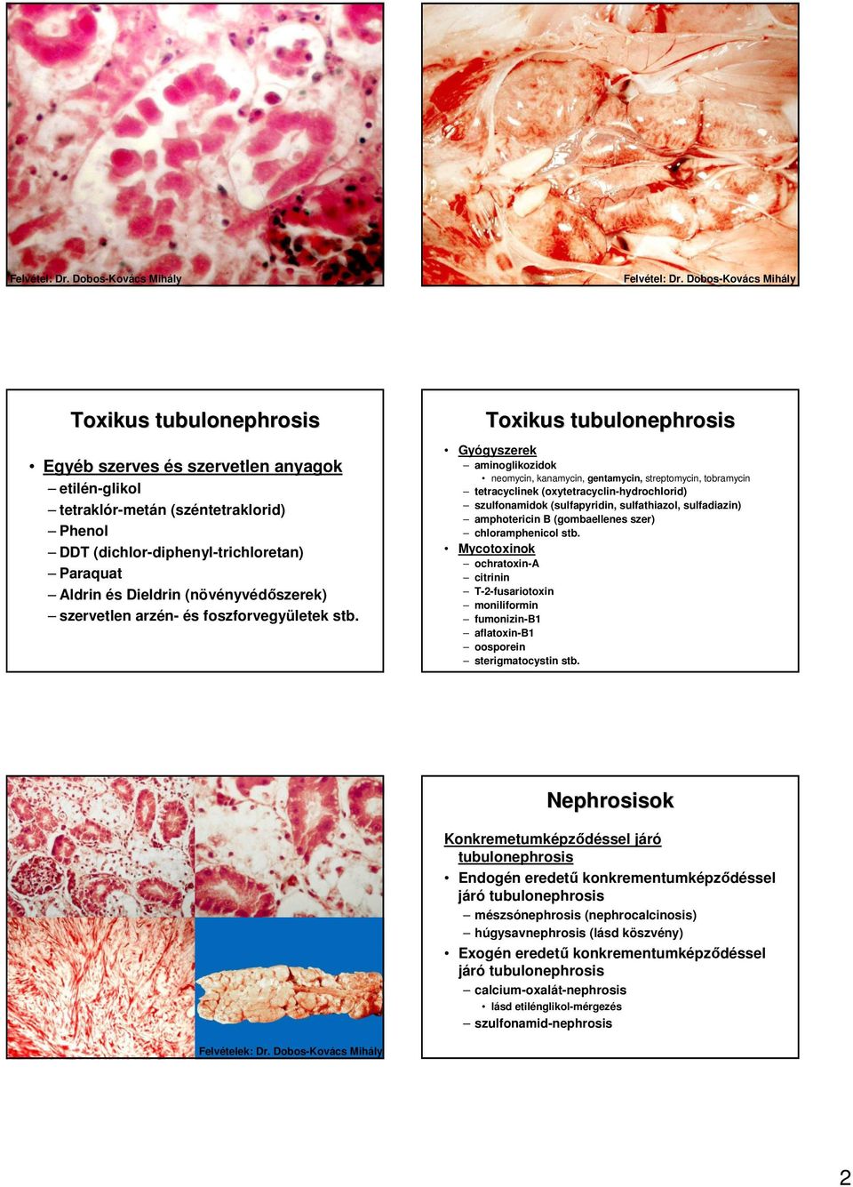 Toxikus tubulonephrosis Gyógyszerek aminoglikozidok neomycin, kanamycin, gentamycin, streptomycin, tobramycin tetracyclinek (oxytetracyclin-hydrochlorid) szulfonamidok (sulfapyridin, sulfathiazol,