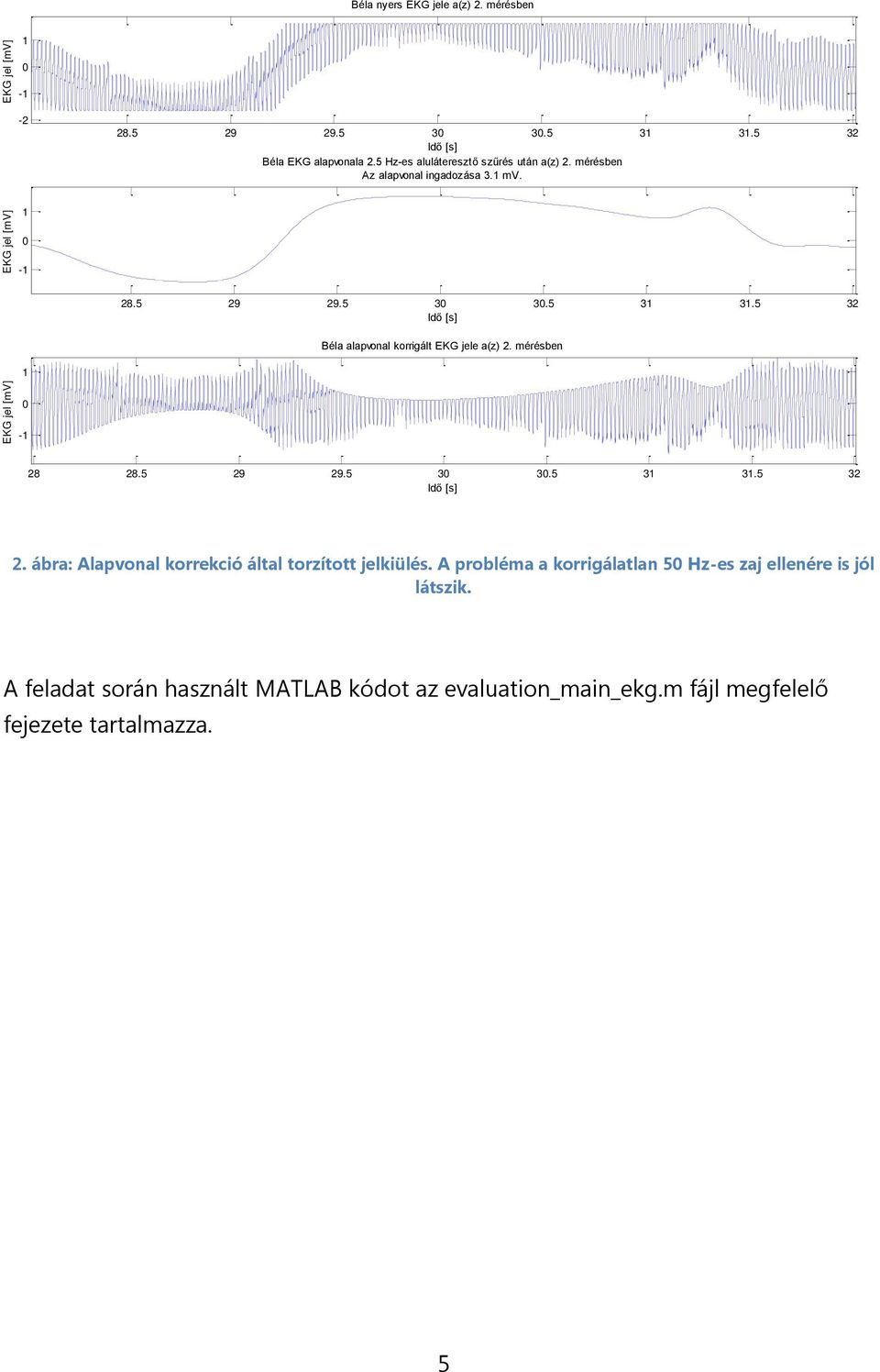 5 3 3.5 32 Béla alapvonal korrigált EKG jele a(z) 2. mérésben - 28 28.5 29 29.5 3 3.5 3 3.5 32 2.