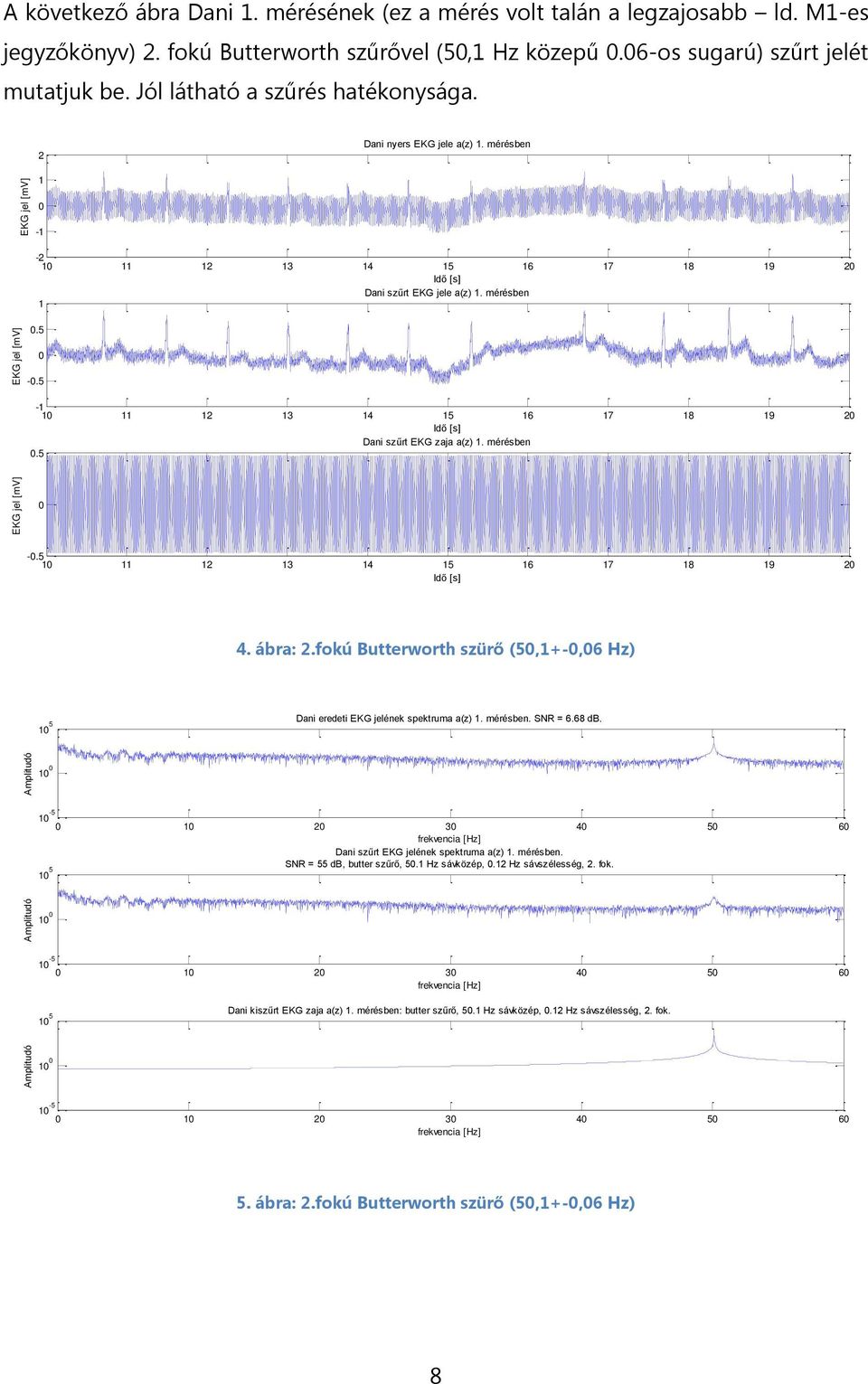 5-2 3 4 5 6 7 8 9 2 Dani szűrt EKG zaja a(z). mérésben.5 -.5 2 3 4 5 6 7 8 9 2 4. ábra: 2.fokú Butterworth szürő (5,+-,6 Hz) 5 Dani eredeti EKG jelének spektruma a(z). mérésben. SNR = 6.68 db.