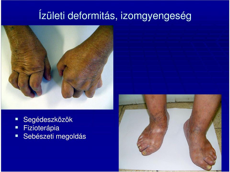 Segédeszközök