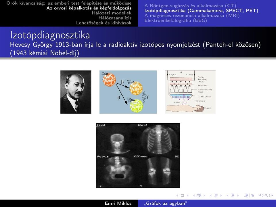 Elektroenkefalográfia (EEG) Izotópdiagnosztika Hevesy György 1913-ban