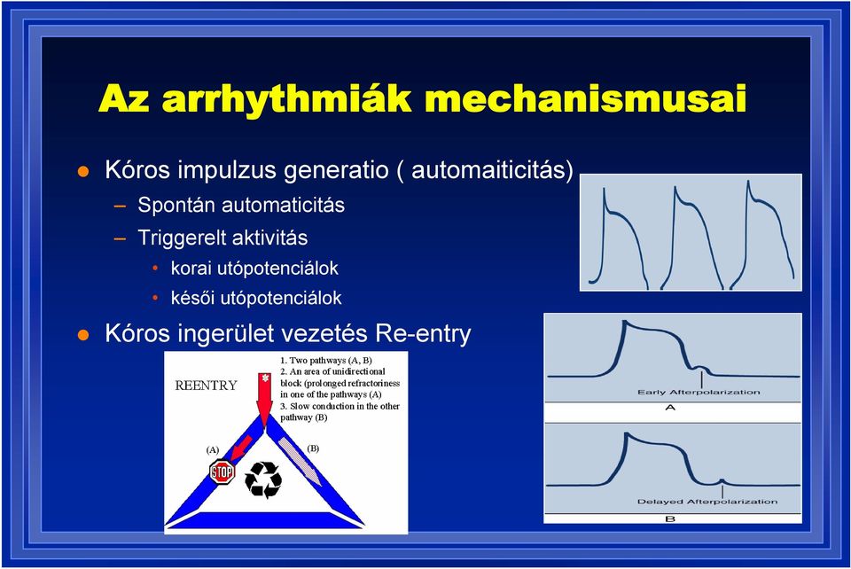 automaticitás Triggerelt aktivitás korai