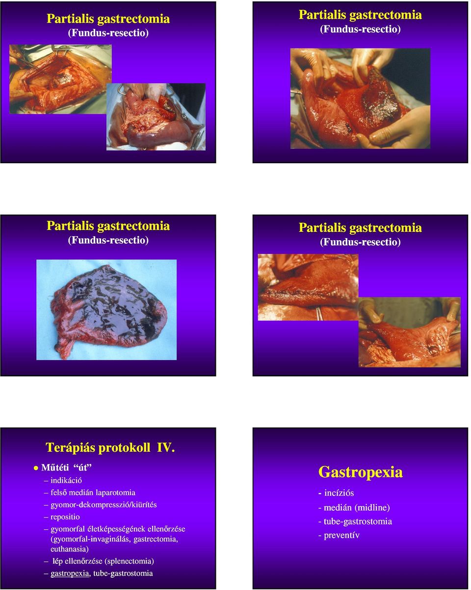 Műtéti út indikáció felső medián laparotomia gyomorgyomor-dekompresszió/kiürítés repositio gyomorfal életképességének ellenőrzése