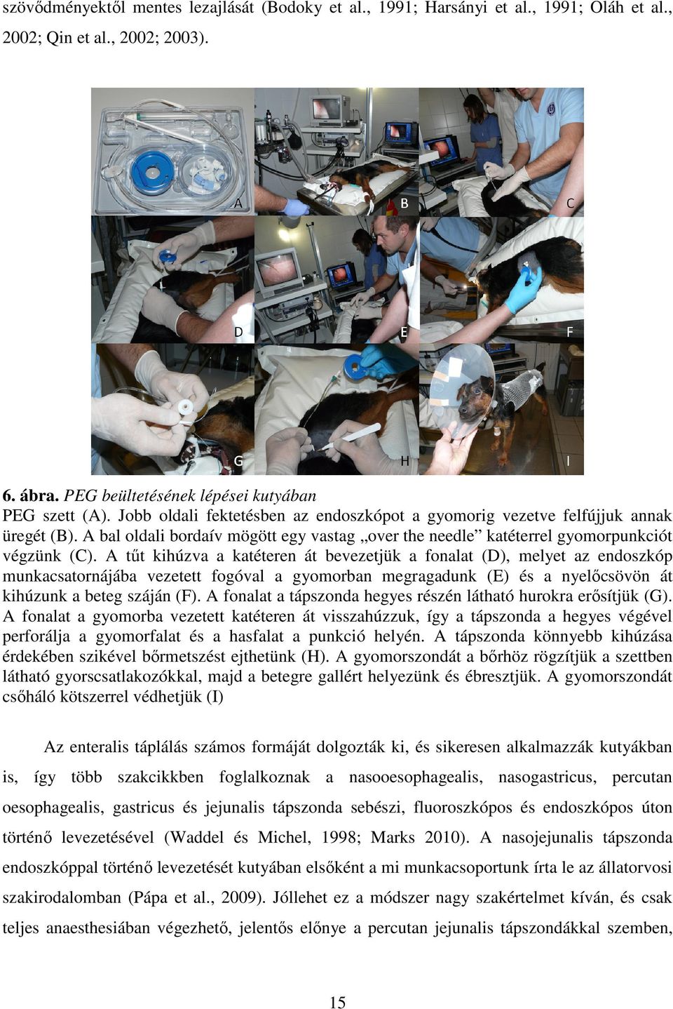 A tűt kihúzva a katéteren át bevezetjük a fonalat (D), melyet az endoszkóp munkacsatornájába vezetett fogóval a gyomorban megragadunk (E) és a nyelőcsövön át kihúzunk a beteg száján (F).