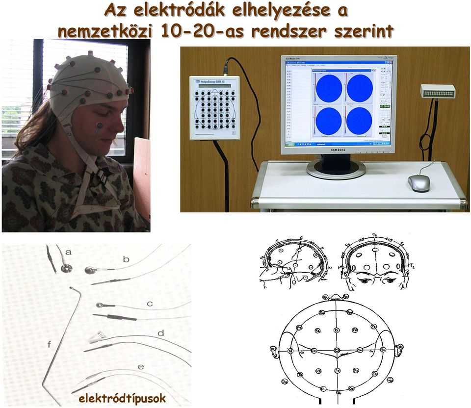 nemzetközi 10-20-as