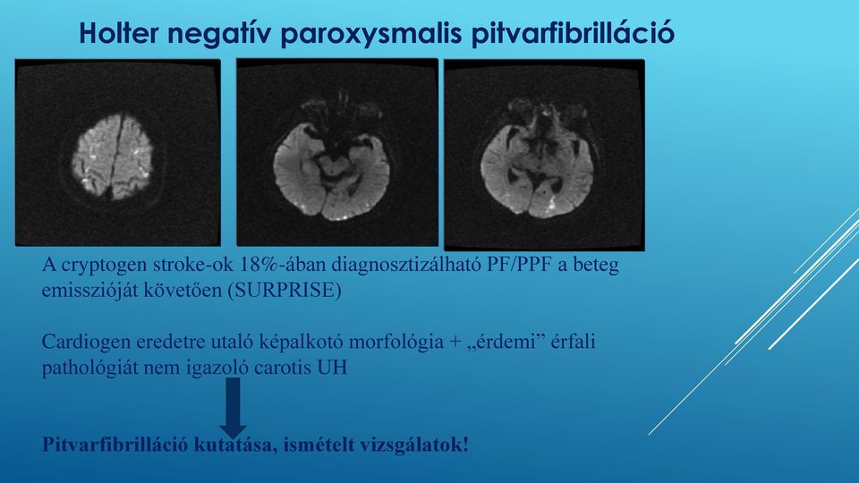 (SURPRISE) Cardiogen eredetre utaló képalkotó morfológia + érdemi