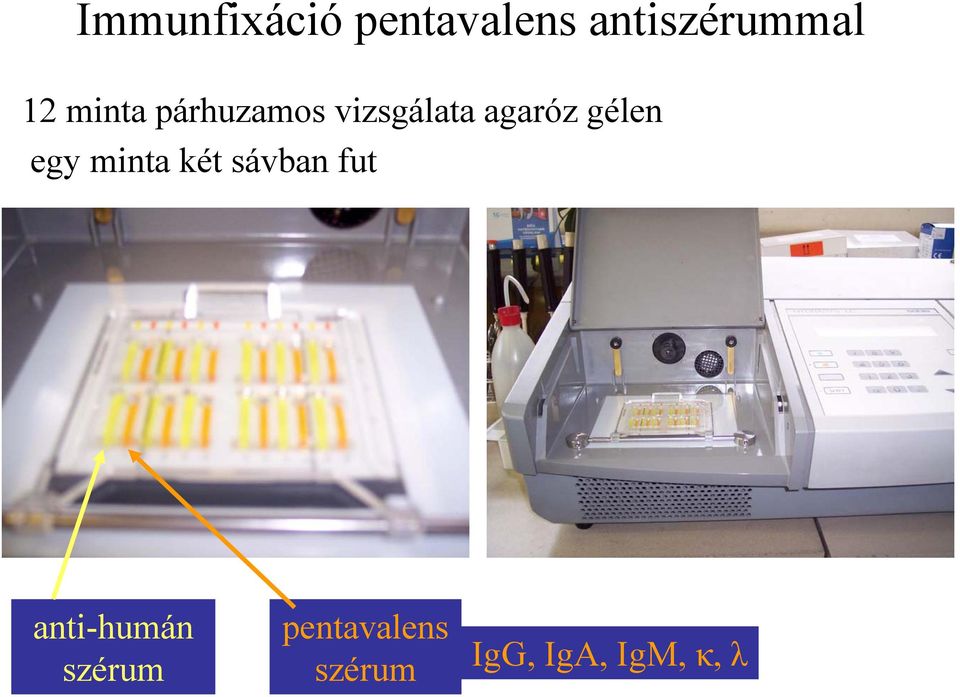 gélen egy minta két sávban fut