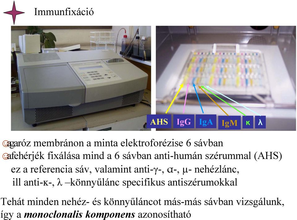 referencia sáv, valamint anti-γ-, α-, µ- nehézlánc, ill anti-ĸ-, λ könnyűlánc specifikus