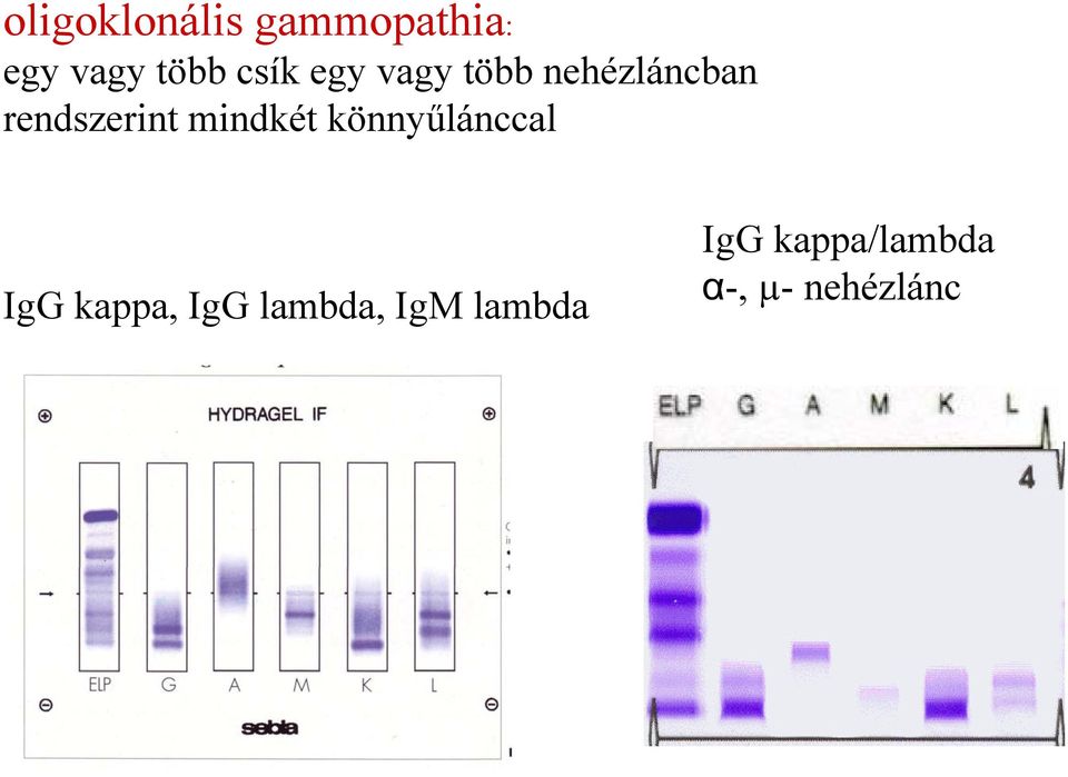 Immunfixáció. diagnosztikai lehetőségek MIT-MLDT Miklós Kata OGYK - PDF  Ingyenes letöltés