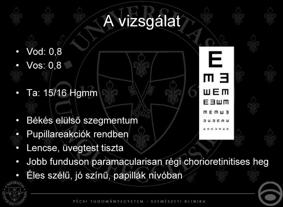 üvegtest tiszta Jobb funduson paramacularisan régi