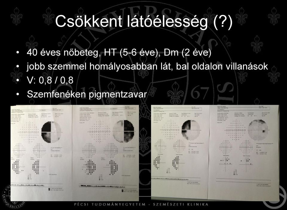 éve) jobb szemmel homályosabban lát,