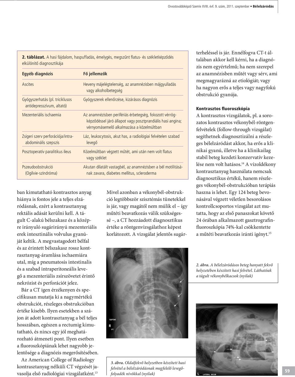 triciklusos antidepresszívum, altató) Mezenteriális ischaemia Zsigeri szerv perforációja/intraabdominális szepszis Posztoperatív paralitikus ileus Pszeudoobstrukció (Ogilvie-szindróma) Fô jellemzôk