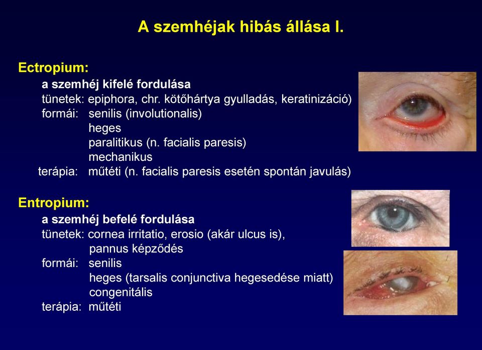 facialis paresis) mechanikus terápia: műtéti (n.