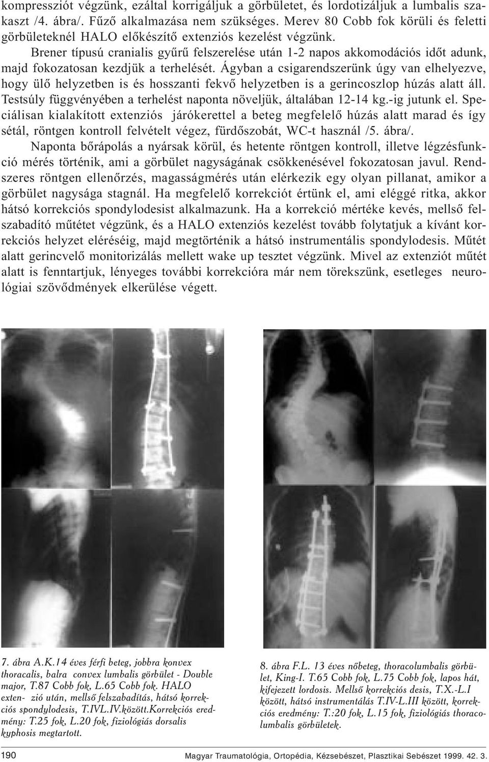 Brener típusú cranialis gyûrû felszerelése után 1-2 napos akkomodációs idõt adunk, majd fokozatosan kezdjük a terhelését.