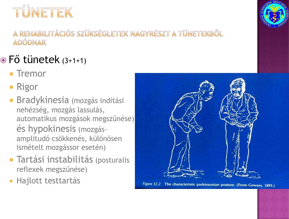 hypokinesis (mozgásamplitudó csökkenés, különösen ismételt