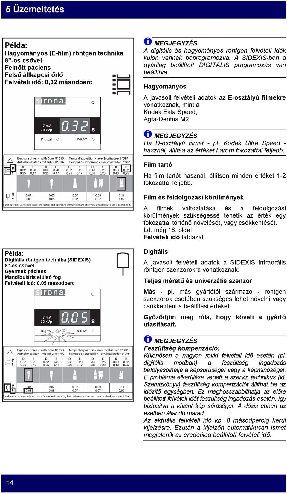 Hagyományos A javasolt felvételi adatok az E-osztályú filmekre vonatkoznak, mint a Kodak Ekta Speed, Agfa-Dentus M2 MEGJEGYZÉS Ha D-osztályú filmet - pl.