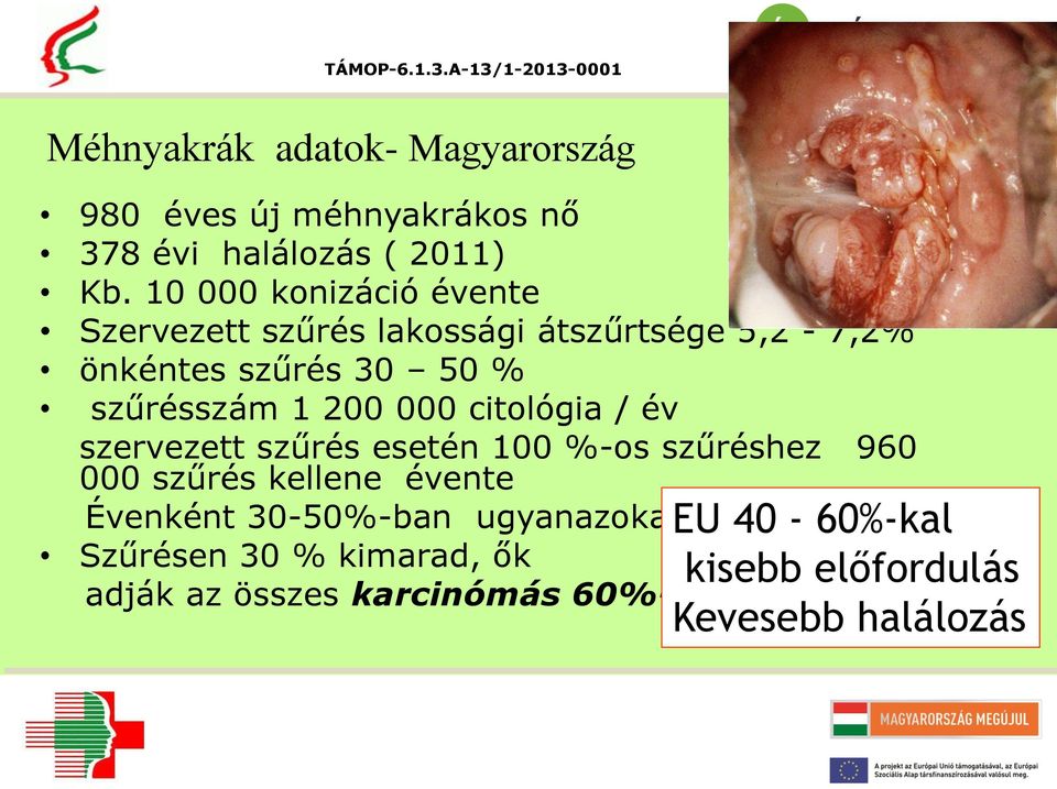 200 000 citológia / év szervezett szűrés esetén 100 %-os szűréshez 960 000 szűrés kellene évente Évenként