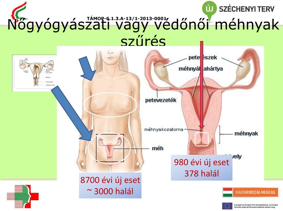 8700 évi új eset ~ 3000