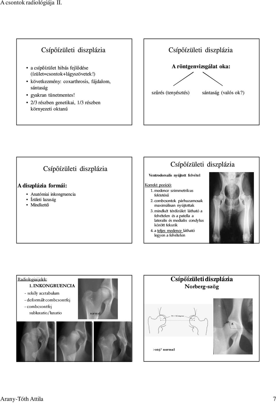 ) A diszplázia formái: Anatómiai inkongruencia Ízületi lazaság Mindkettı Ventrodorsalis nyújtott felvétel Korrekt pozíció: 1. medence szimmetrikus fektetésű 2.