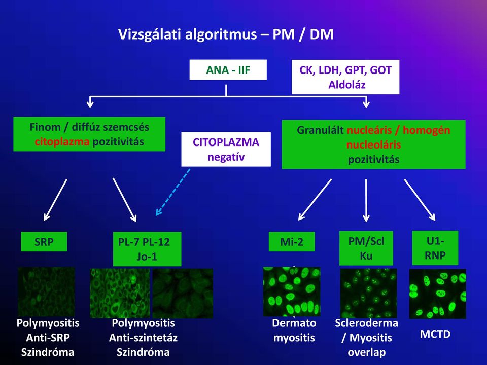 nucleoláris pozitivitás SRP PL 7 PL 12 Jo 1 Mi 2 PM/Scl U1 Ku RNP Polymyositis Anti
