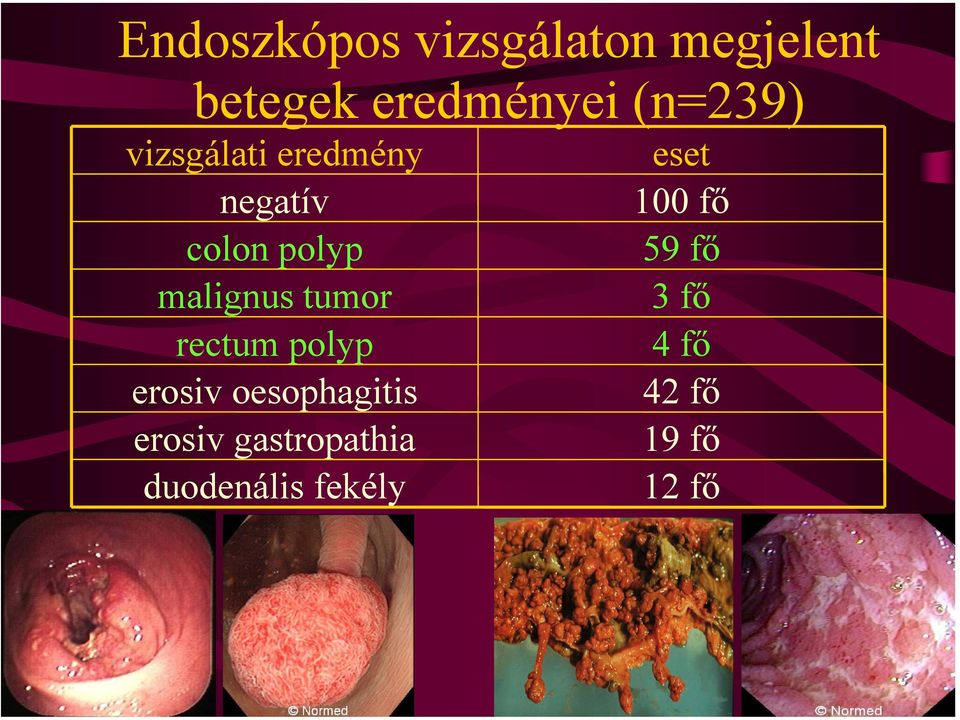 tumor rectum polyp erosiv oesophagitis erosiv