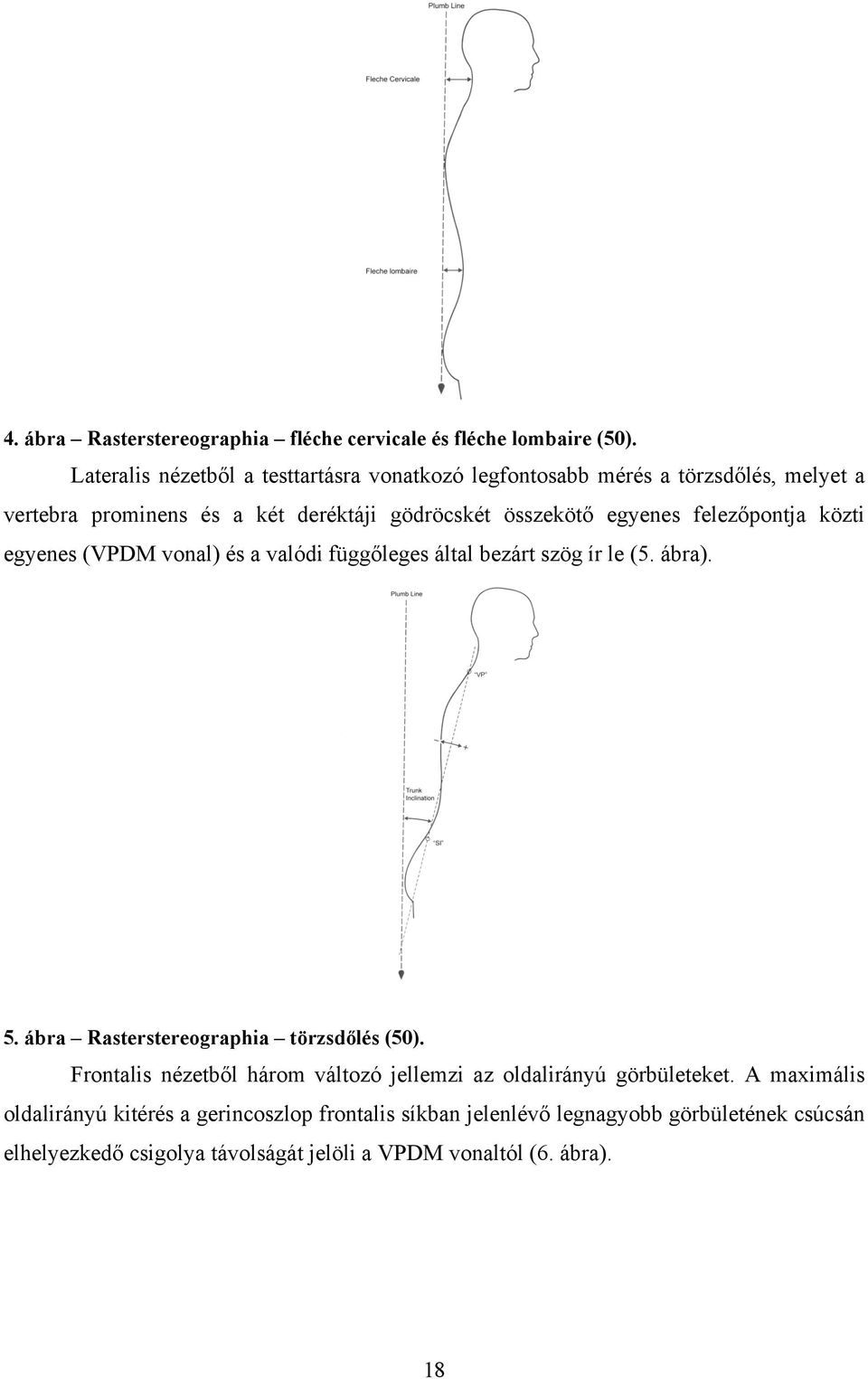 felezőpontja közti egyenes (VPDM vonal) és a valódi függőleges által bezárt szög ír le (5. ábra). 5. ábra Rasterstereographia törzsdőlés (50).