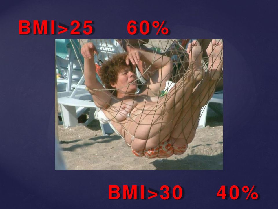 BMI>30