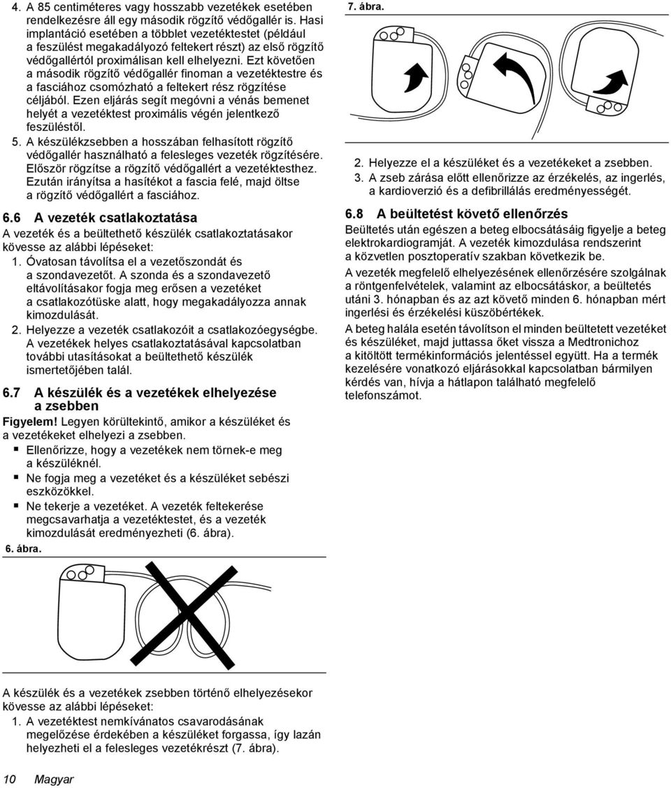 Ezt követően a második rögzítő védőgallér finoman a vezetéktestre és a fasciához csomózható a feltekert rész rögzítése céljából.