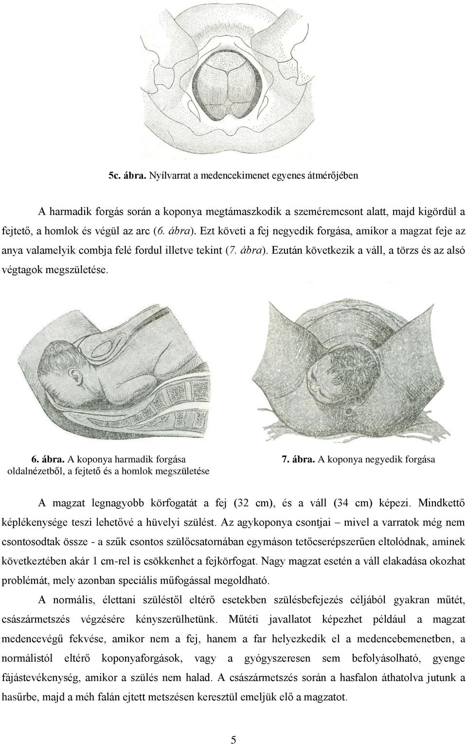 ábra. A koponya negyedik forgása A magzat legnagyobb körfogatát a fej (32 cm), és a váll (34 cm) képezi. Mindkettő képlékenysége teszi lehetővé a hüvelyi szülést.