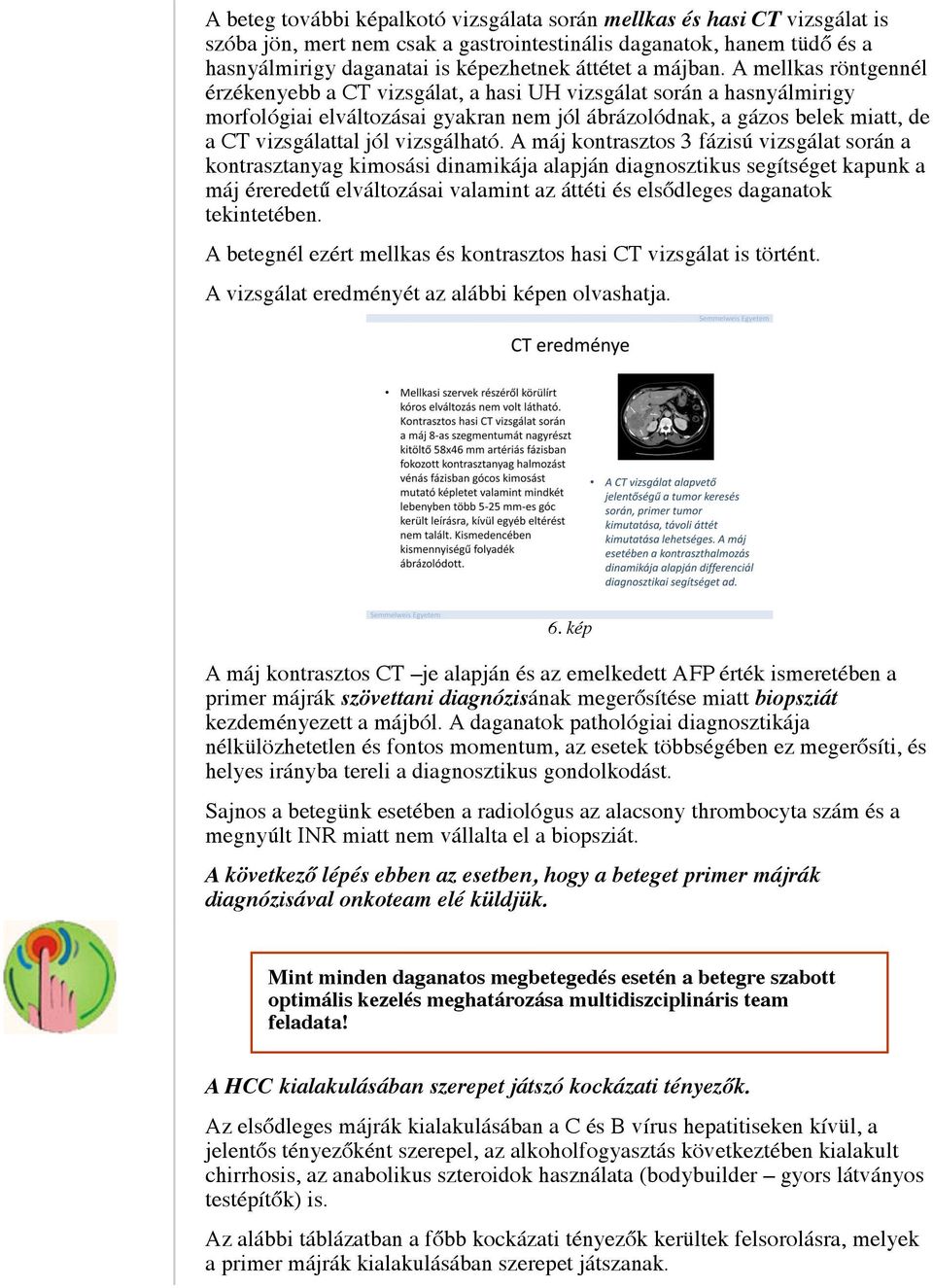 A mellkas röntgennél érzékenyebb a CT vizsgálat, a hasi UH vizsgálat során a hasnyálmirigy morfológiai elváltozásai gyakran nem jól ábrázolódnak, a gázos belek miatt, de a CT vizsgálattal jól