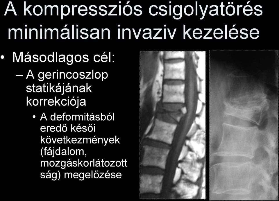 statikájának korrekciója A deformitásból eredő