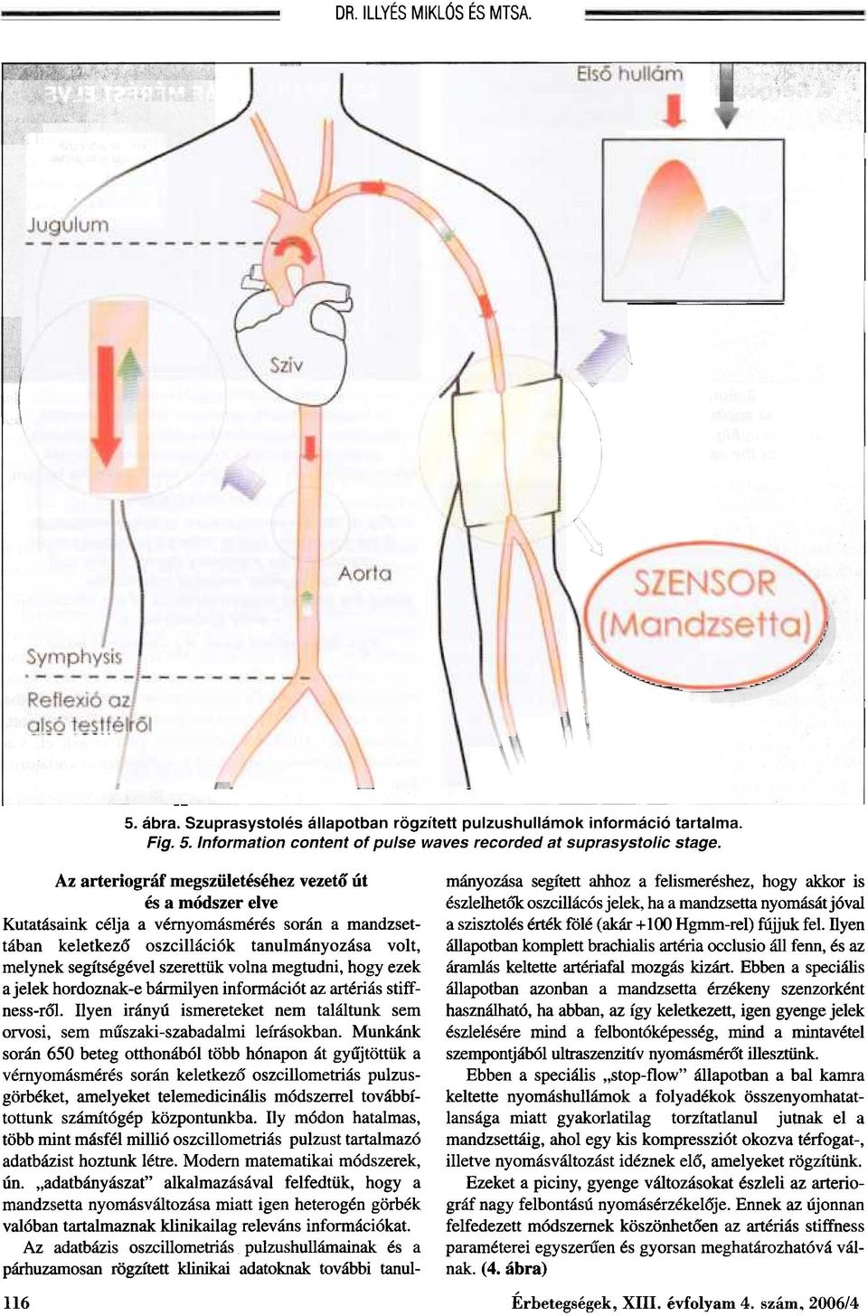 megtudni, hogy ezek a jelek hordoznak-e bármilyen információt az artériás stiffness-rõl. Ilyen irányú ismereteket nem találtunk sem orvosi, sem mûszaki-szabadalmi leírásokban.