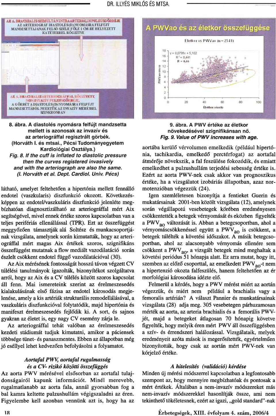 Horváth et a/. Dept. Cardio/. Univ; Pécs) látható, amelyet feltehetõen a hipertónia mellett fennálló endotel (vaszkularis) diszfunkció okozott.